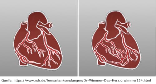 Herz bildet kleine Blutgefäße